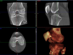 Bildgebung des offenen CTs