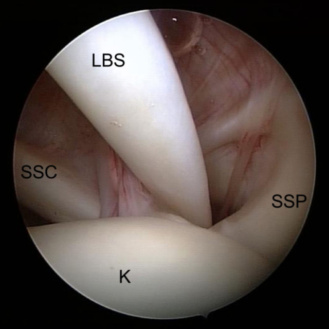 Der sogenannte Bizeps-Pulley