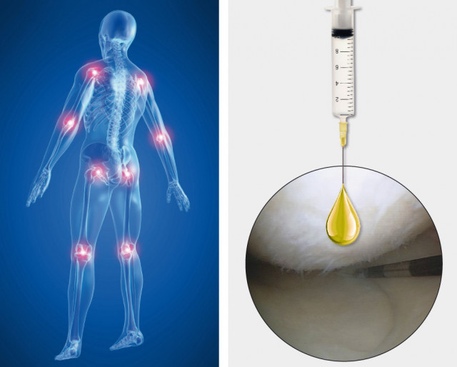 Hyaluronsäure künstlicher Mensch mit roten Spots