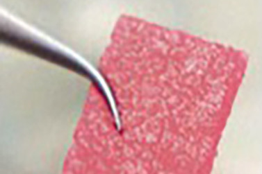 Transplantat zur Knorpelzelltransplantation