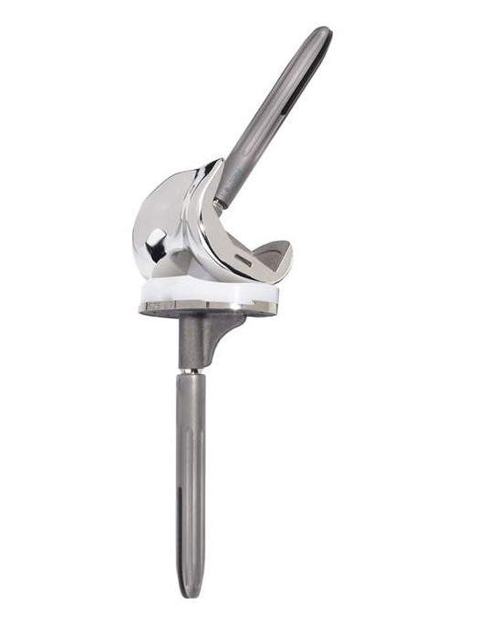 schaftverankerte Knieimplantat