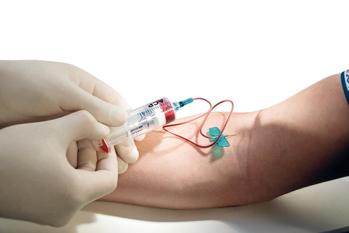 Arm Wird Taub Im Armband Welche medikamente enthalten chondroitin und